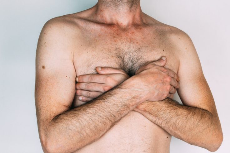 gynecomastia testosterone